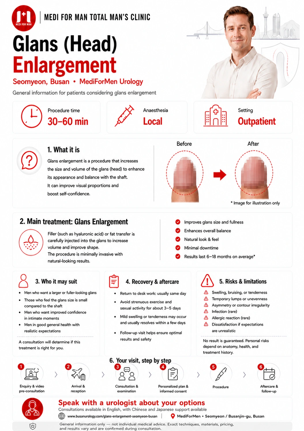Glans (Head) Enlargement infographic — MediForMen, Seomyeon, Busan